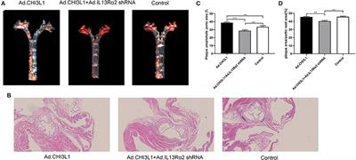 Downregulation of Interleukin-13 Receptor α2 Inhibits Angiogenic Formation Mediated by Chitinase 3-Like 1 in Late Atherosclerotic Lesions of apoE−/− Mice